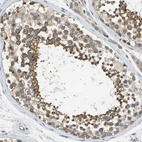 Immunohistochemical staining of human testis shows strong cytoplasmic positivity in spermatids.