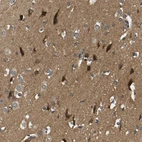 Immunohistochemical staining of human cerebral cortex shows strong cytoplasmic positivity in neurons.
