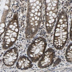 Immunohistochemical staining of human rectum shows strong cytoplasmic positivity in glandular cells.