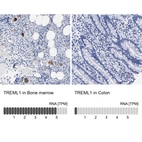 Anti-TREML1 Antibody
