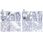 Immunohistochemical staining of human bone marrow, colon, kidney and testis using Anti-TREML1 antibody HPA017860 (A) shows similar protein distribution across tissues to independent antibody HPA016700 (B).