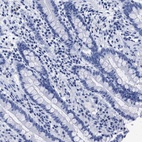 Anti-TREML1 Antibody
