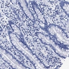 Immunohistochemical staining of human colon shows low expression as expected.