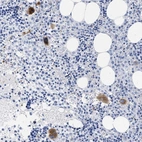 Immunohistochemical staining of human bone marrow shows high expression.