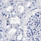 Immunohistochemical staining of human kidney using Anti-TREML1 antibody HPA017860.
