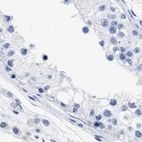 Immunohistochemical staining of human testis using Anti-TREML1 antibody HPA017860.