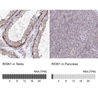 Anti-RIOK1 Antibody