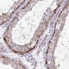 Immunohistochemical staining of human testis shows moderate cytoplasmic positivity in subset of cells in seminiferous ducts.