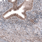 Anti-TNRC6A Antibody
