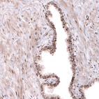Immunohistochemical staining of human prostate shows strong nuclear combined with weaker granular cytoplasmic positivity in glandular cells.