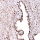 Immunohistochemical staining of human prostate shows strong nuclear combined with weaker granular cytoplasmic positivity in glandular cells.