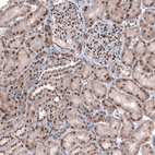 Anti-TNRC6A Antibody