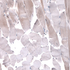 Immunohistochemical staining of human skeletal muscle shows very weak nuclear and cytoplasmic positivity in striated muscle fibers.
