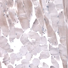 Immunohistochemical staining of human skeletal muscle shows very weak nuclear and cytoplasmic positivity in striated muscle fibers.
