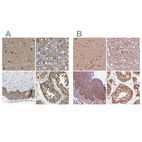 Anti-PSMC5 Antibody