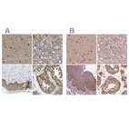 Anti-PSMC5 Antibody