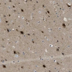 Immunohistochemical staining of human cerebral cortex shows strong nuclear positivity in neurons.