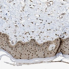 Immunohistochemical staining of human skin shows strong nuclear positivity in squamous epithelial cells.