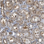 Immunohistochemical staining of human kidney shows moderate nuclear positivity in cells in tubules.