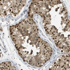 Immunohistochemical staining of human testis shows strong nuclear positivity in cells in seminiferous ducts.