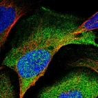 Immunofluorescent staining of human cell line U-2 OS shows localization to plasma membrane & cytosol.