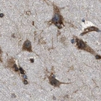Immunohistochemical staining of human cerebral cortex using Anti-KTN1 antibody HPA017876.