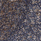Immunohistochemical staining of human lymph node using Anti-KTN1 antibody HPA017876.