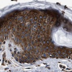 Immunohistochemical staining of human skin using Anti-KTN1 antibody HPA017876.