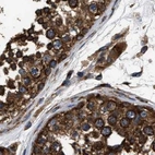 Immunohistochemical staining of human testis using Anti-KTN1 antibody HPA017876.