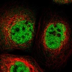 Immunofluorescent staining of human cell line A-431 shows localization to nucleoplasm.