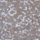 Anti-FRRS1 Antibody