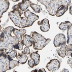 Immunohistochemical staining of human placenta shows strong cytoplasmic positivity in trophoblastic cells.