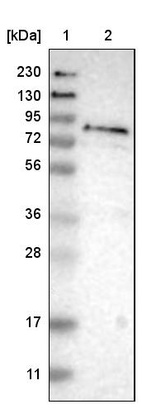 Lane 1: Marker [kDa] 230, 130, 95, 72, 56, 36, 28, 17, 11_br/_Lane 2: Human cell line RT-4