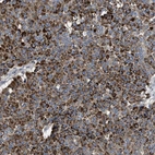 Anti-GPR179 Antibody