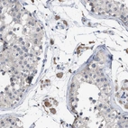 Immunohistochemical staining of human testis shows moderate membranous and cytoplasmic positivity in Leydig cells.