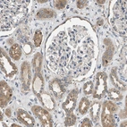 Immunohistochemical staining of human kidney shows moderate cytoplasmic positivity in cells in tubules.
