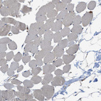 Immunohistochemical staining of human skeletal muscle shows no cytoplasmic positivity in myocytes as expected.