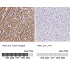 Anti-TNNT2 Antibody