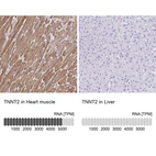 Anti-TNNT2 Antibody
