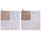 Immunohistochemical staining of human heart muscle, kidney, liver and skeletal muscle using Anti-TNNT2 antibody HPA017888 (A) shows similar protein distribution across tissues to independent antibody HPA015774 (B).