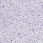 Immunohistochemical staining of human liver shows no positivity in hepatocytes as expected.