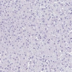 Immunohistochemical staining of human liver shows no positivity in hepatocytes as expected.