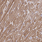 Immunohistochemical staining of human heart muscle shows strong cytoplasmic positivity in cardiomyocytes.