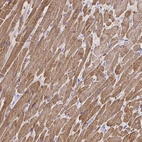 Immunohistochemical staining of human heart muscle shows strong cytoplasmic positivity in cardiomyocytes.