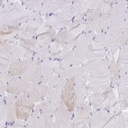 Immunohistochemical staining of human skeletal muscle shows very weak positivity in myocytes.