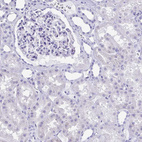 Immunohistochemical staining of human kidney shows no positivity in cells in tubules as expected.