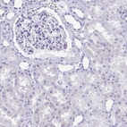 Immunohistochemical staining of human kidney shows no positivity in cells in tubules as expected.
