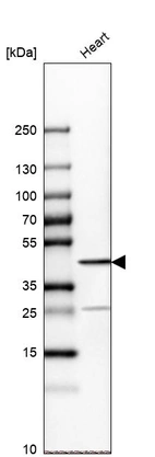 Western blot analysis in human heart tissue.