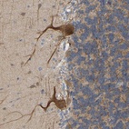 Anti-BEND3 Antibody
