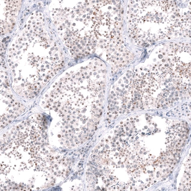 Anti-RRP1B Antibody